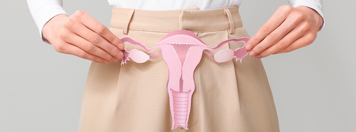 Pólipos menstruales Mujer con una maquetas de útero