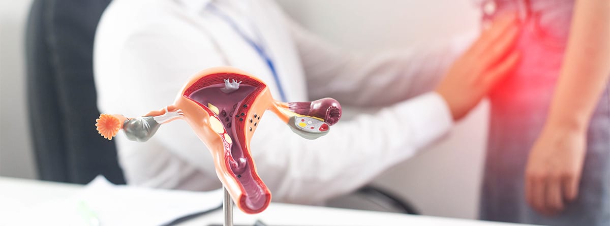 Maqueta de útero en consulta de ginecólogo