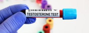 Test de testosterona