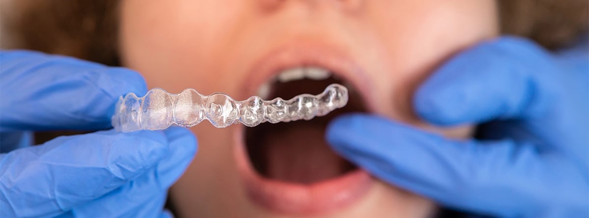 Retenedores removibles