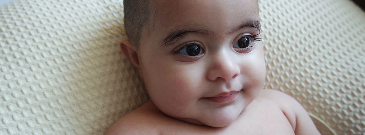 bebé con síndrome kabuki