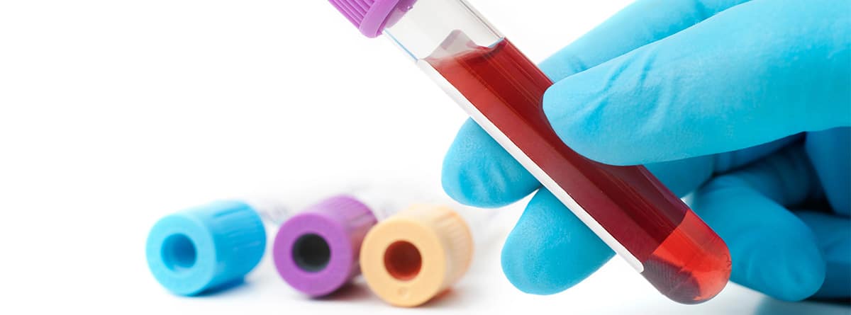 Tubos de análisis de sangre