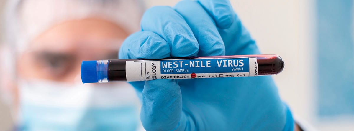 Médico con mascarilla sujetando un tubo de pruebas