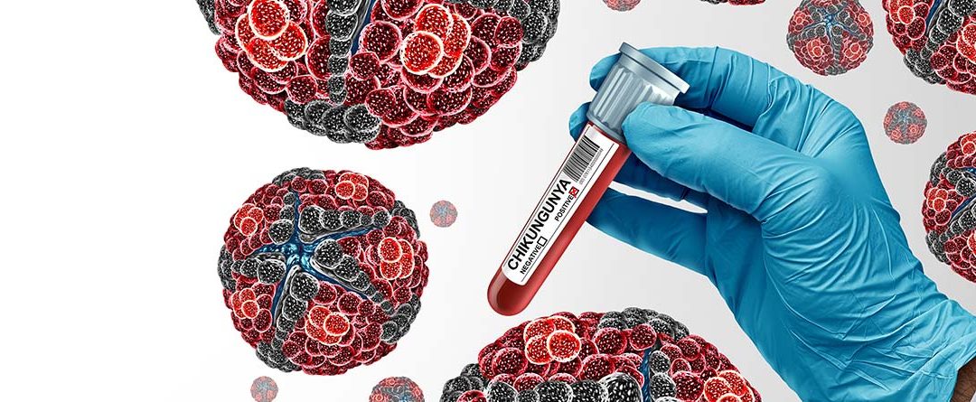 Virus de chikungunya: qué es y cómo evitarlo