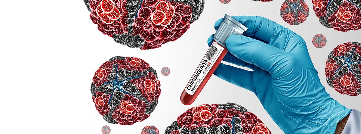 VIRUS DE CHIKUNGUNYA: QUÉ ES Y CÓMO EVITARLO tubo de muestra de sangre