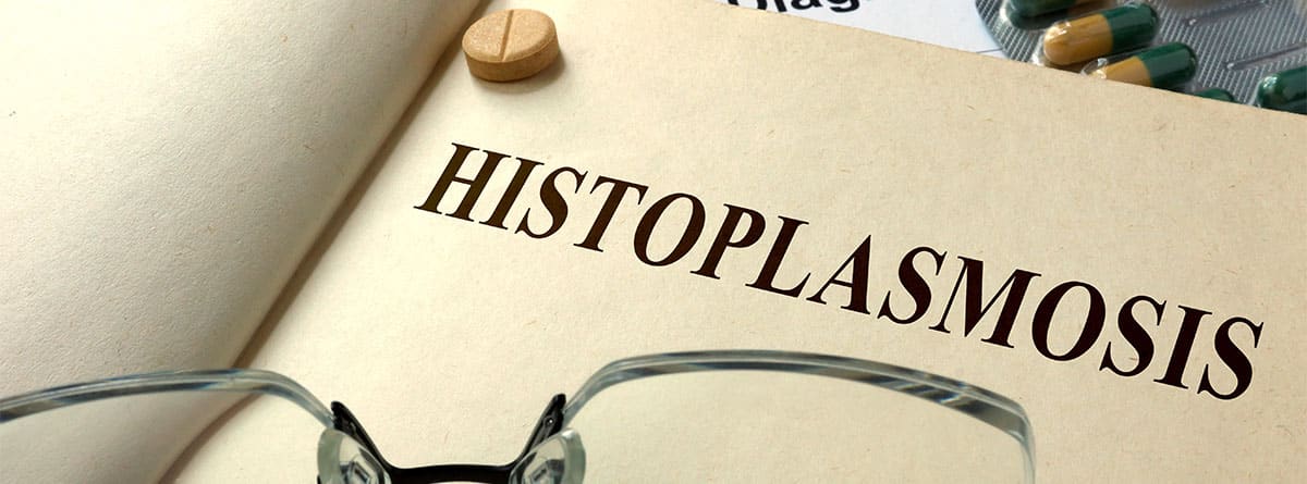 Libro sobre histoplasmosis