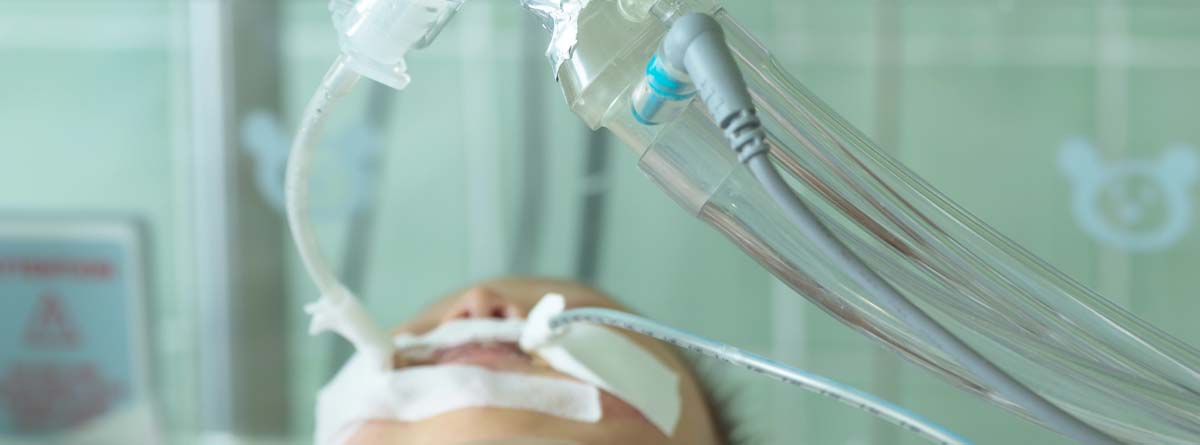 Bebé con respirador