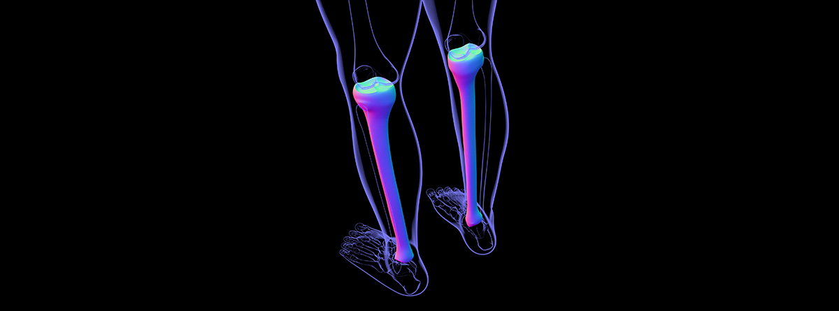 Periostitis tibial ilustración sobre los huesos tibial