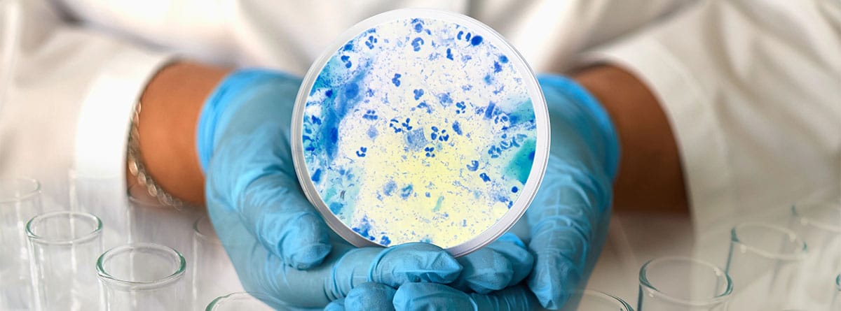 Plaqueta de laboratorio