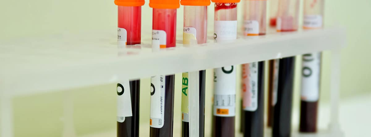Tubos de análisis de sangre