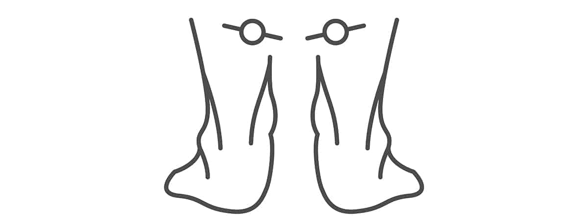 Ilustración pisada tipo pronador