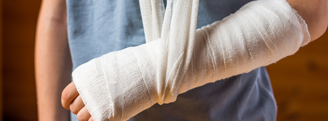 Fracturas más frecuentes en niños Brazo de un niño vendado