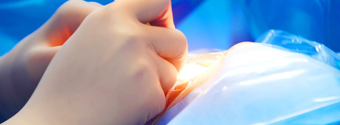 cirugia-refractiva-presbicia-3