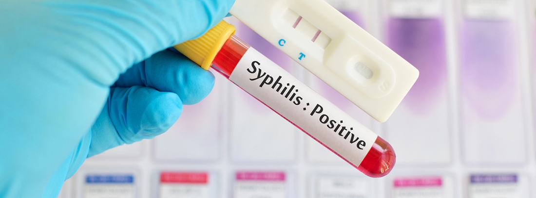Sifilis Etapas Sintomas Tratamiento Y Mas Canalsalud