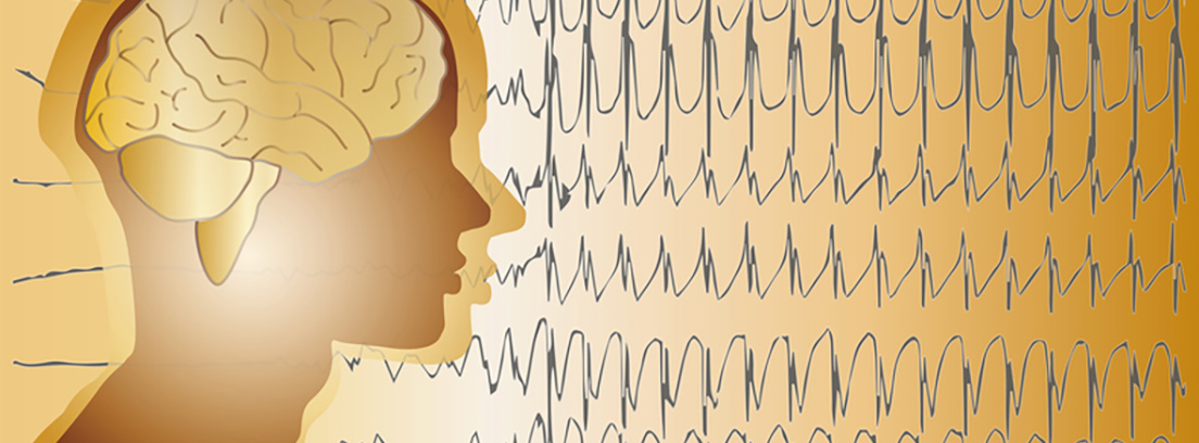 epilepsia-3