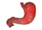 Enfermedades por aparatos. Aparato digestivo. Trastornos del estómago y del duodeno. Gastritis