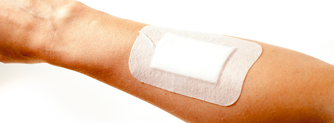 hidradenitis-supurativa-1