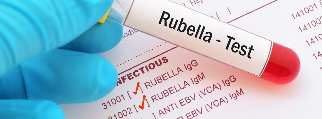 rubeola-3