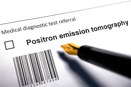diagnóstico del tes de omagrafía por emisión de positrones