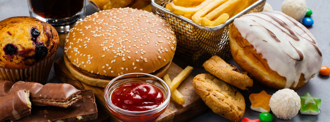 alimentos-prohibidos-deporte-entr