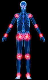 ataxia