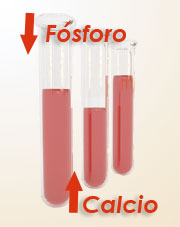 Falta de calcio en sangre sintomas