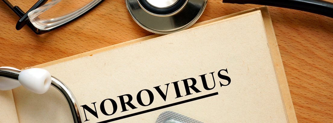 norovirus-diagnóstico