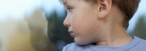 Tortícolis en el bebé Niño girando el cuello y con el músculo esternocleidomastoideo marcado