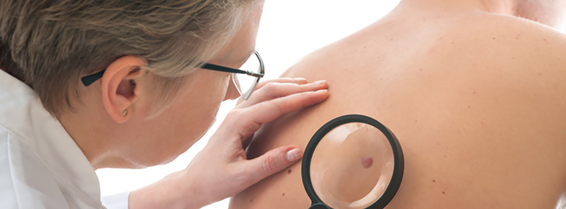 ultimo-contra-melanoma-3