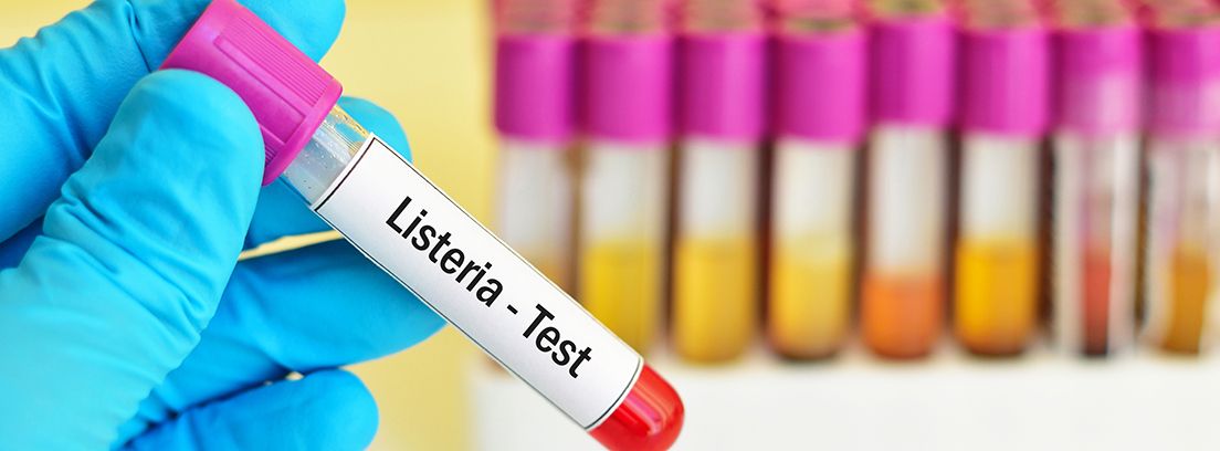 listeria mano con un guante azul sujetando un tubo de análisis de listería