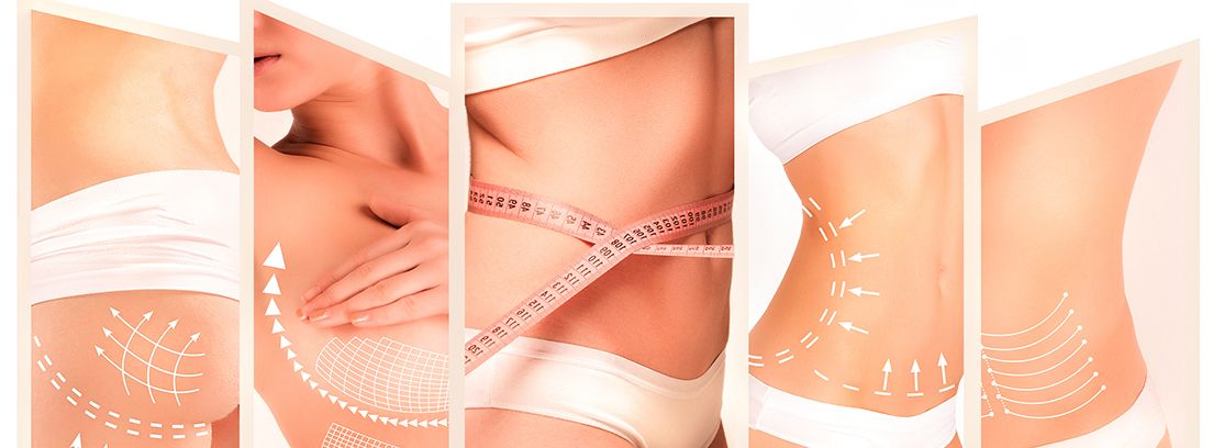 operaciones-de-estética diferentes casos de cirugía estética en mujer