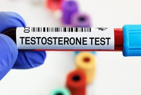 Test de testosterona