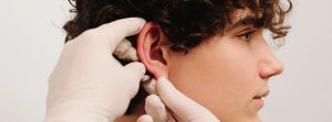 Otoplastia