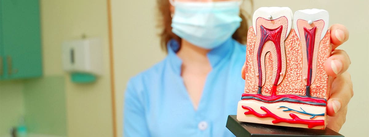 Pulpotomía infantil Mujer dentista sujetando una maqueta de un molar