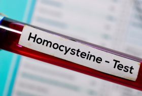 Tubo de análisis de sangre con etiqueta de homocisteína