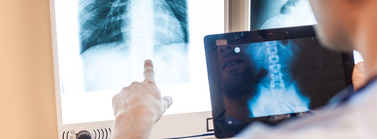 Radiografía de espalda