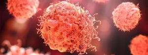 Imagen de un melanoma