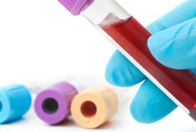 Tubos de análisis de sangre