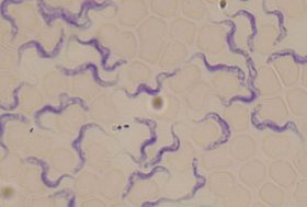 Virus desde visión microscópica