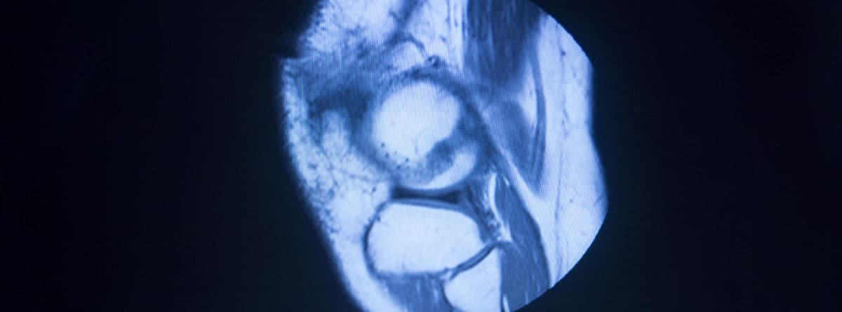 Tac de rodilla