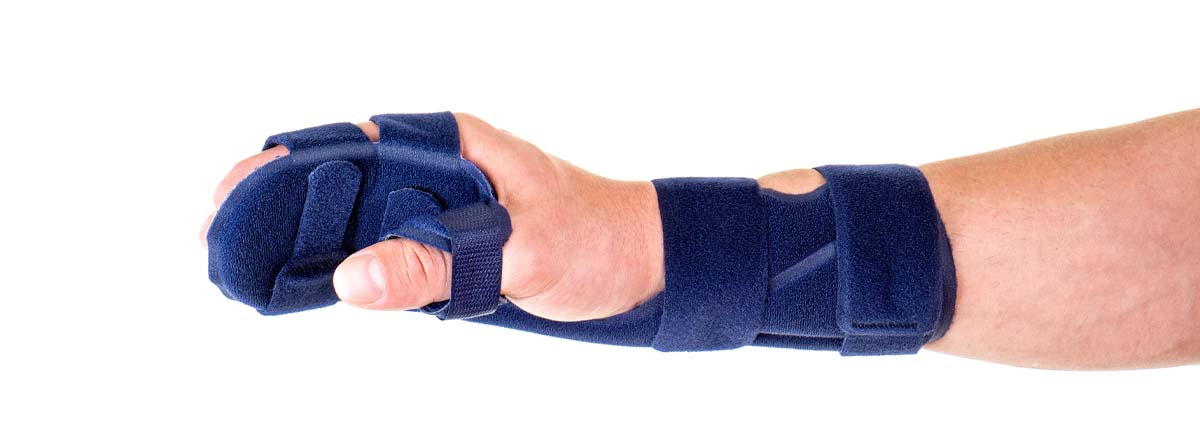 Mano de hombre con cabestrillo protésico
