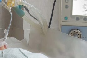 Bebé con respirador