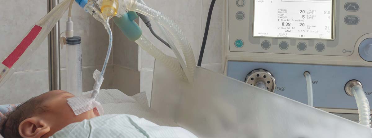 Bebé con respirador