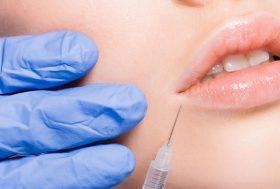 Labios de mujer y una mano con guante quirúrgico inyectándose