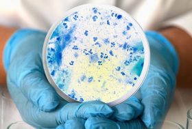 Plaqueta de laboratorio