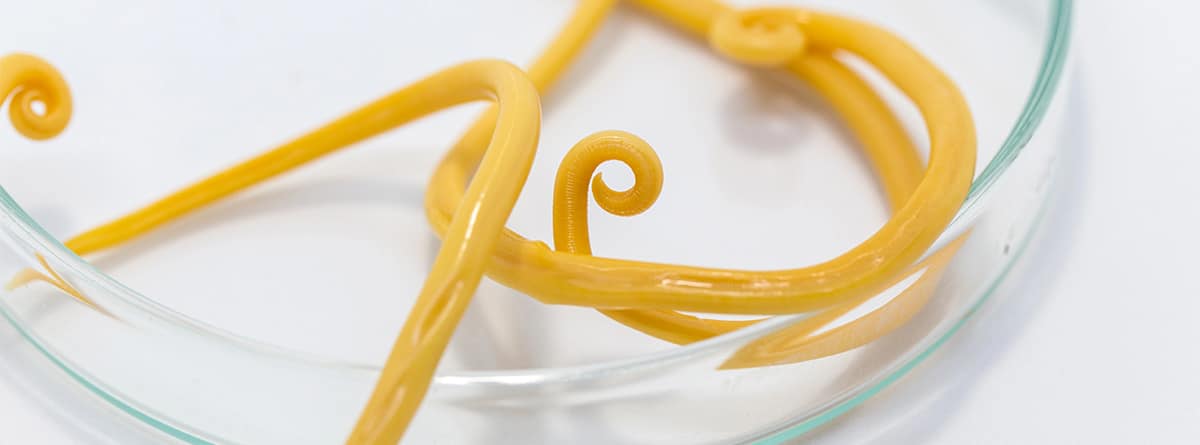 Ascariasis Ascariasis